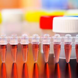 PIPETMAX® 268: Automating 384-Well qPCR  Plate Preparation